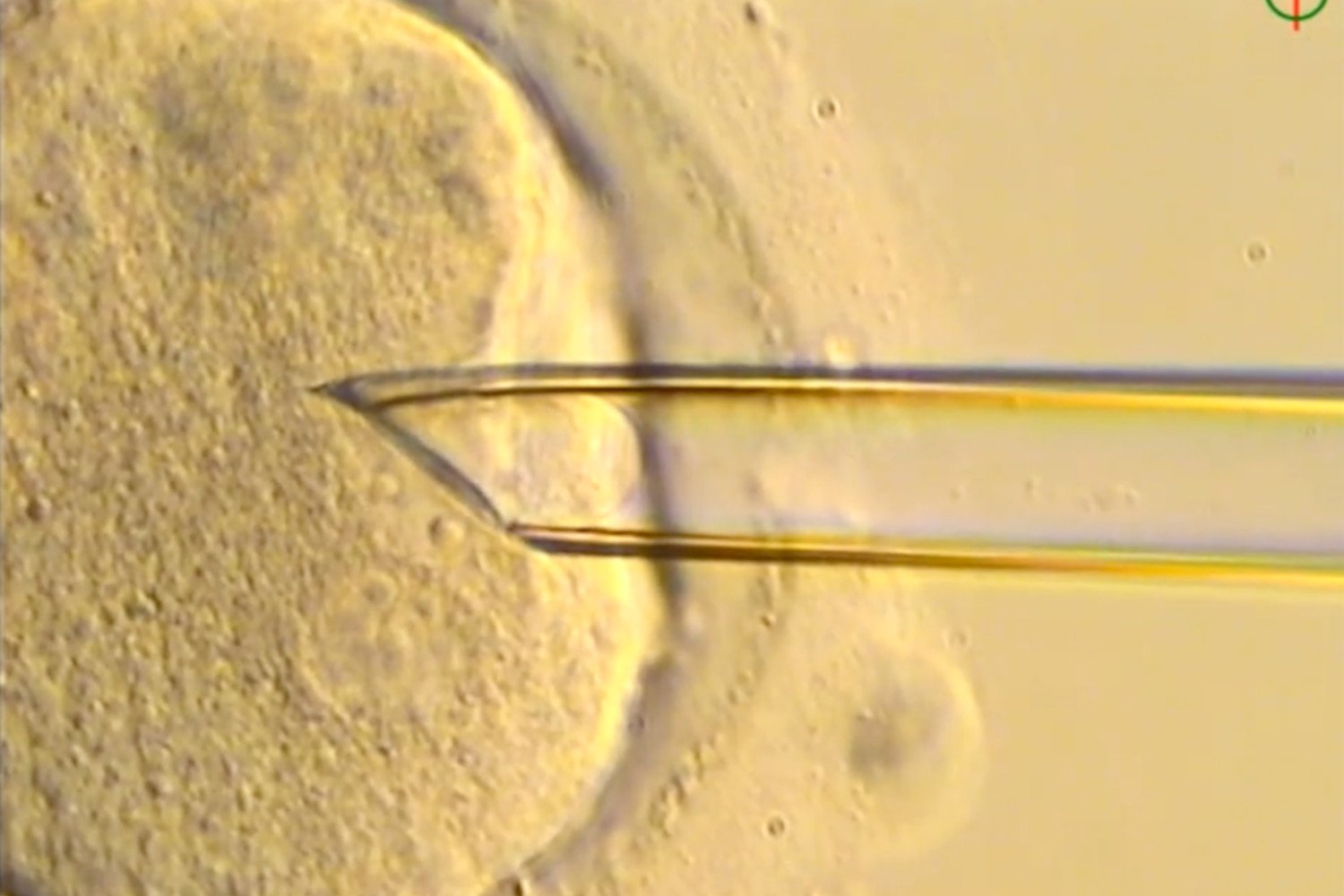8 Healthy ‘Three-Parent’ Babies Born in UK Using Pioneering IVF Technique