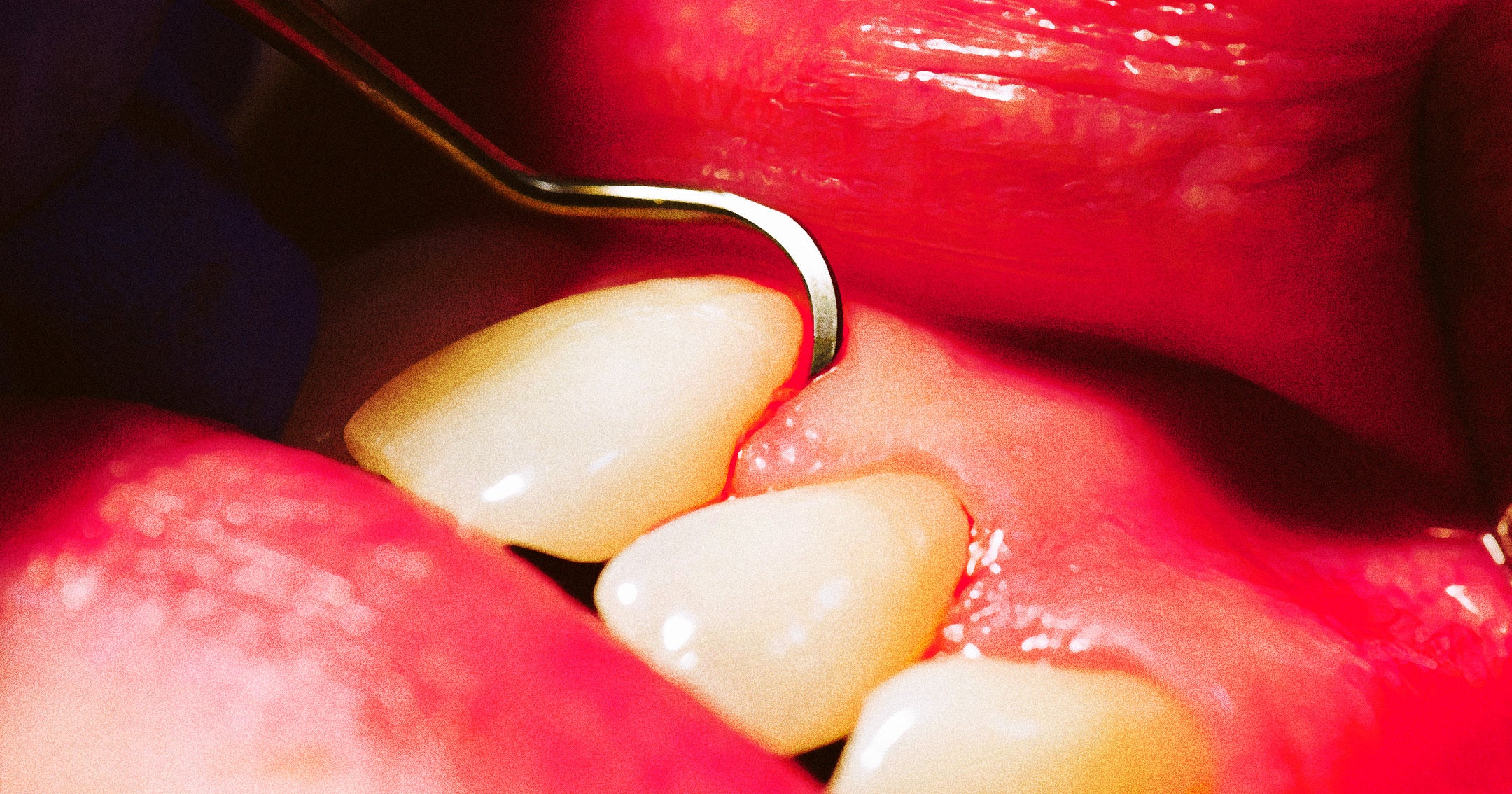 “McDonald’s for Teeth”: Private Equity is Destroying Our Teeth, Dental Professionals Warn