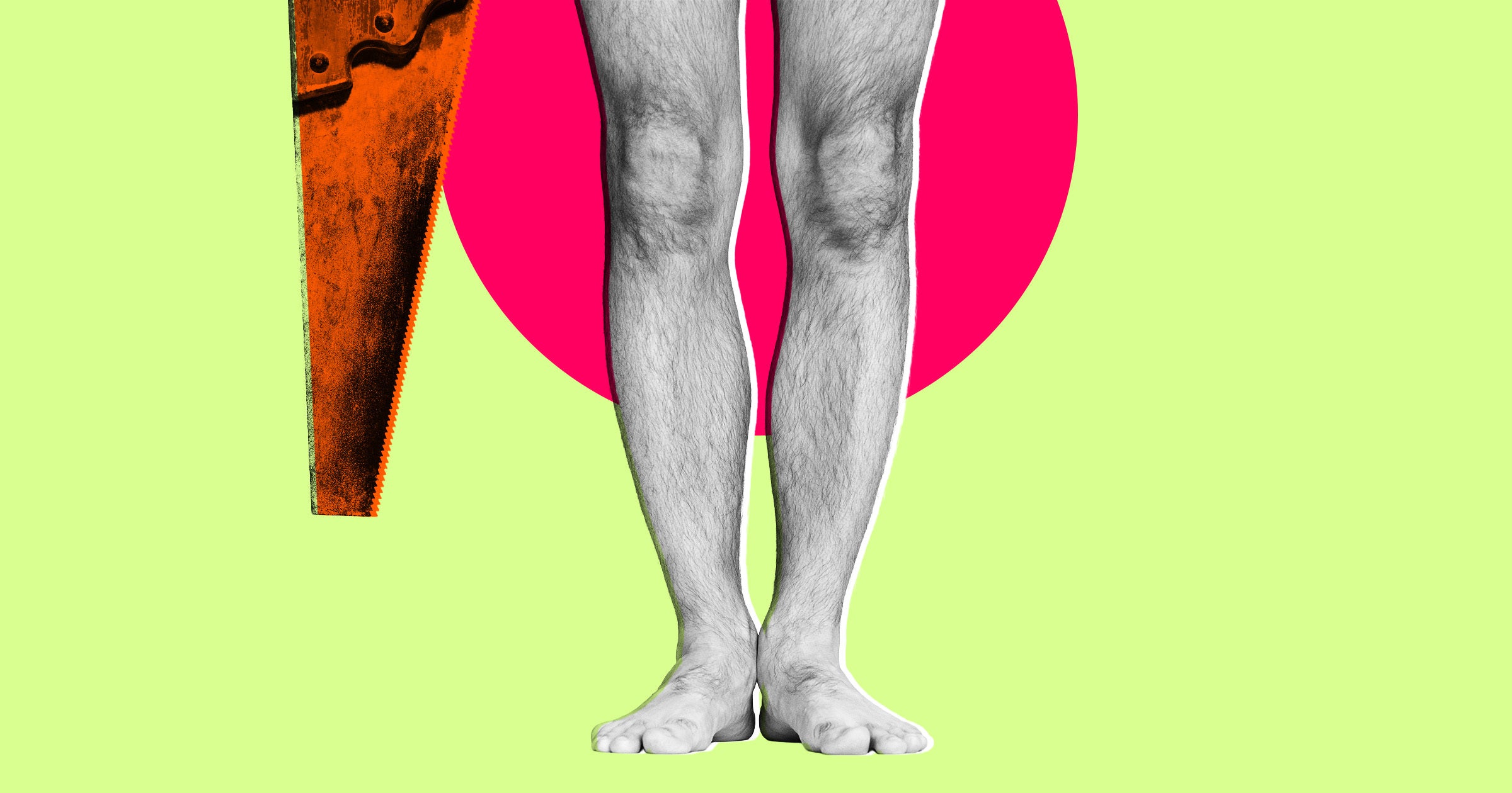 Surgeon Accused of Getting His Own Legs Cut Off for Insurance Reasons