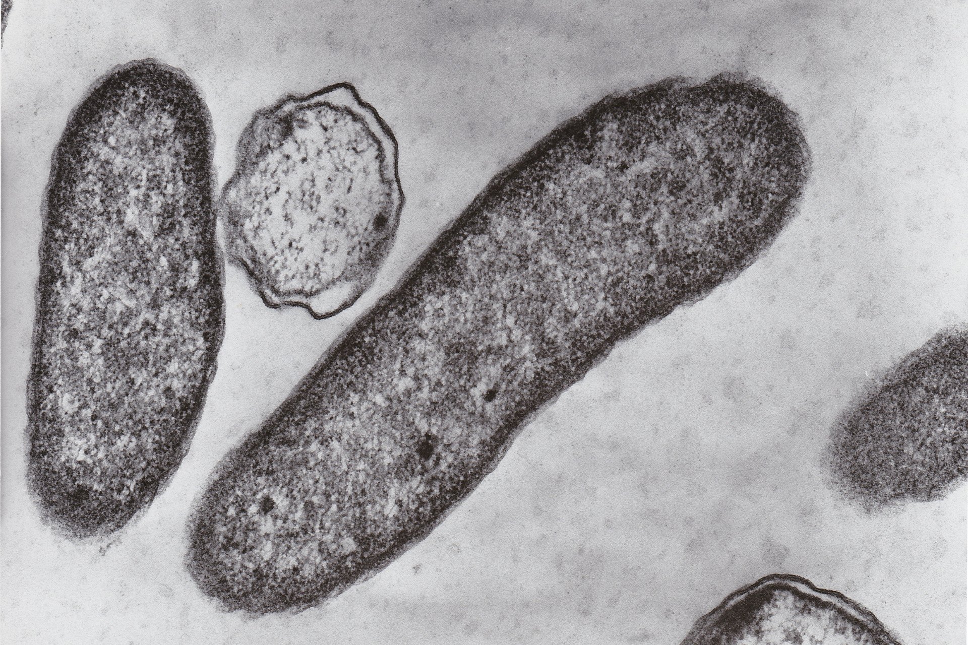 A ‘Flesh-Eating’ Germ Is on the Rise This Summer