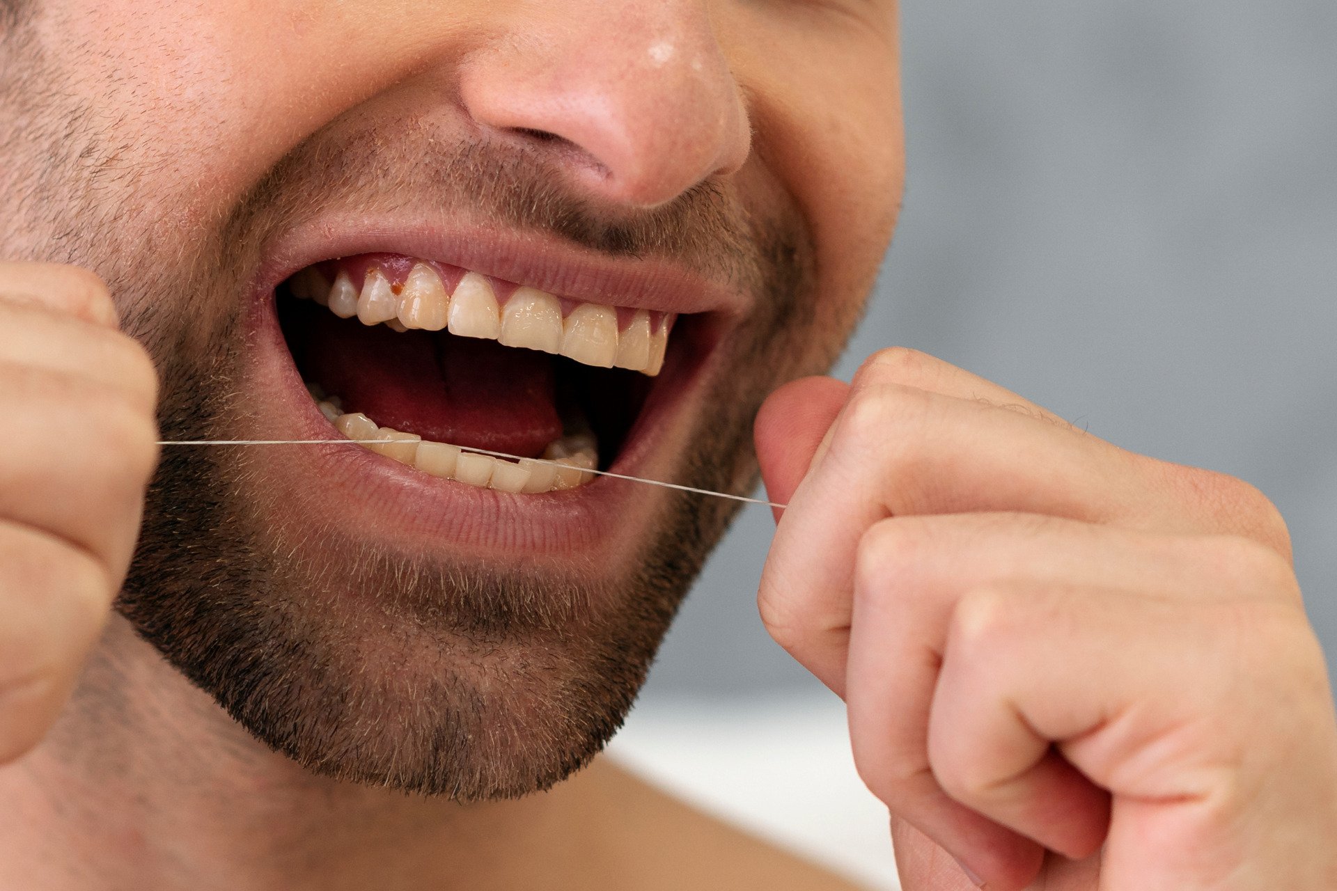 Dental Floss Could Deliver Next-Gen Vaccines, No Needles Required
