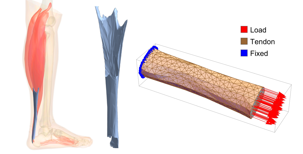 From MRI to Model: In Silico Medicine with Wolfram Language