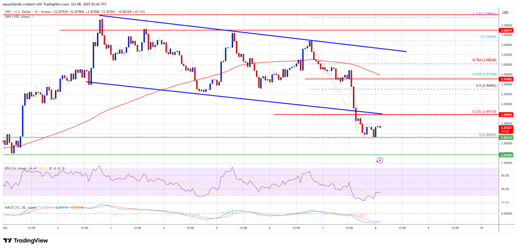 XRP Price Dips Below Support – Is A Bearish Breakdown Now Underway?
