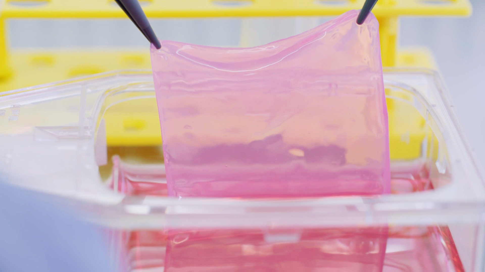 Survivors of Swiss ski resort fire treated with skin grown from their own cells