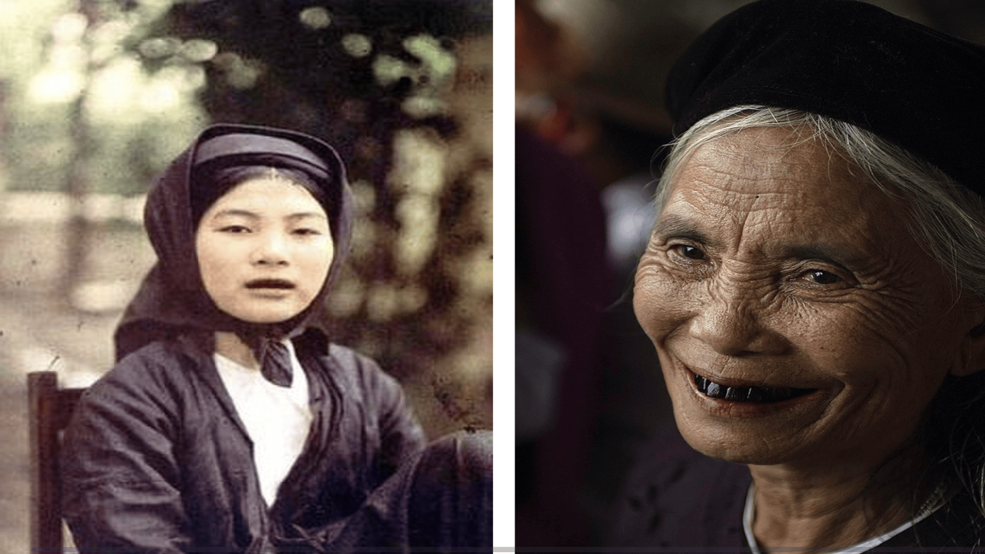 2,000-year-old Vietnamese burial produces oldest evidence of tooth blackening