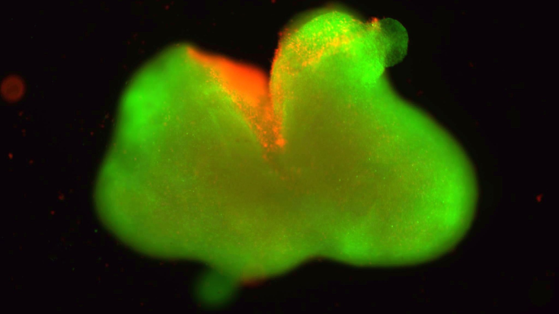 Breakthrough human spinal cord organoids revive hope for paralysis repair