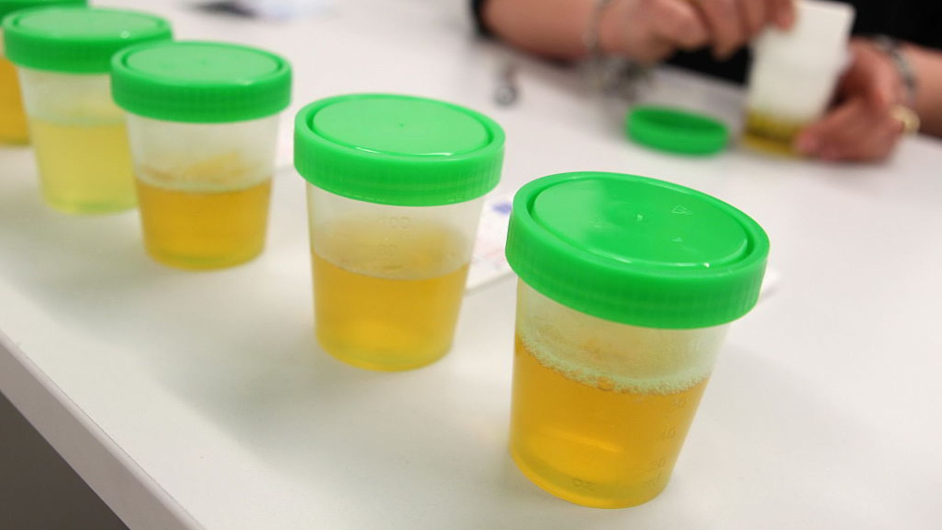New method turns human urine into clean electricity using microbial fuel cells