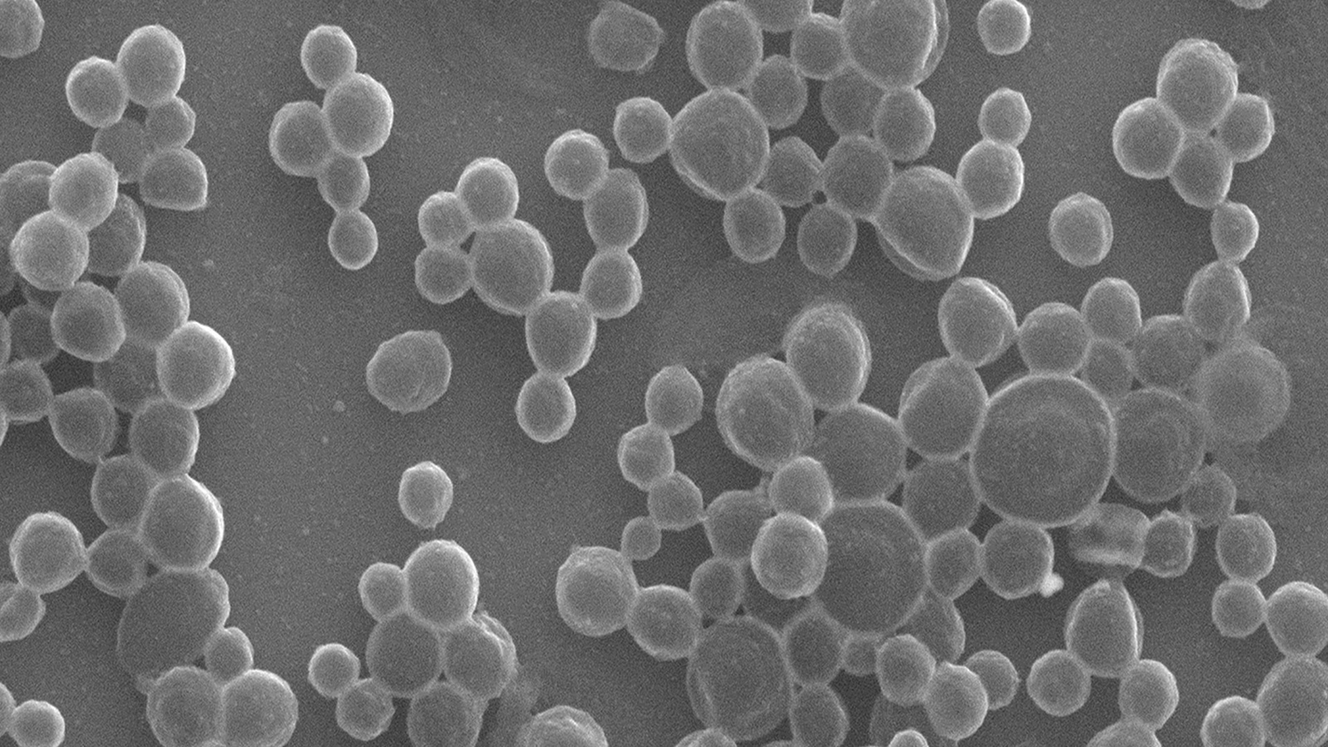 Simple microbubble robots use enzymes to navigate tumors and deliver drugs