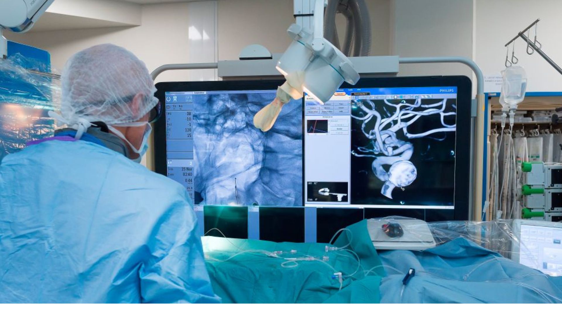 China’s first approved vascular robot achieves 100% success rate in clinical trial