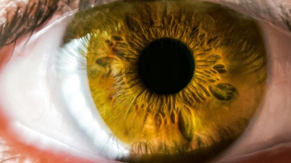 Bixonimania: KI-Chatbots fielen auf eine erfundene Krankheit herein