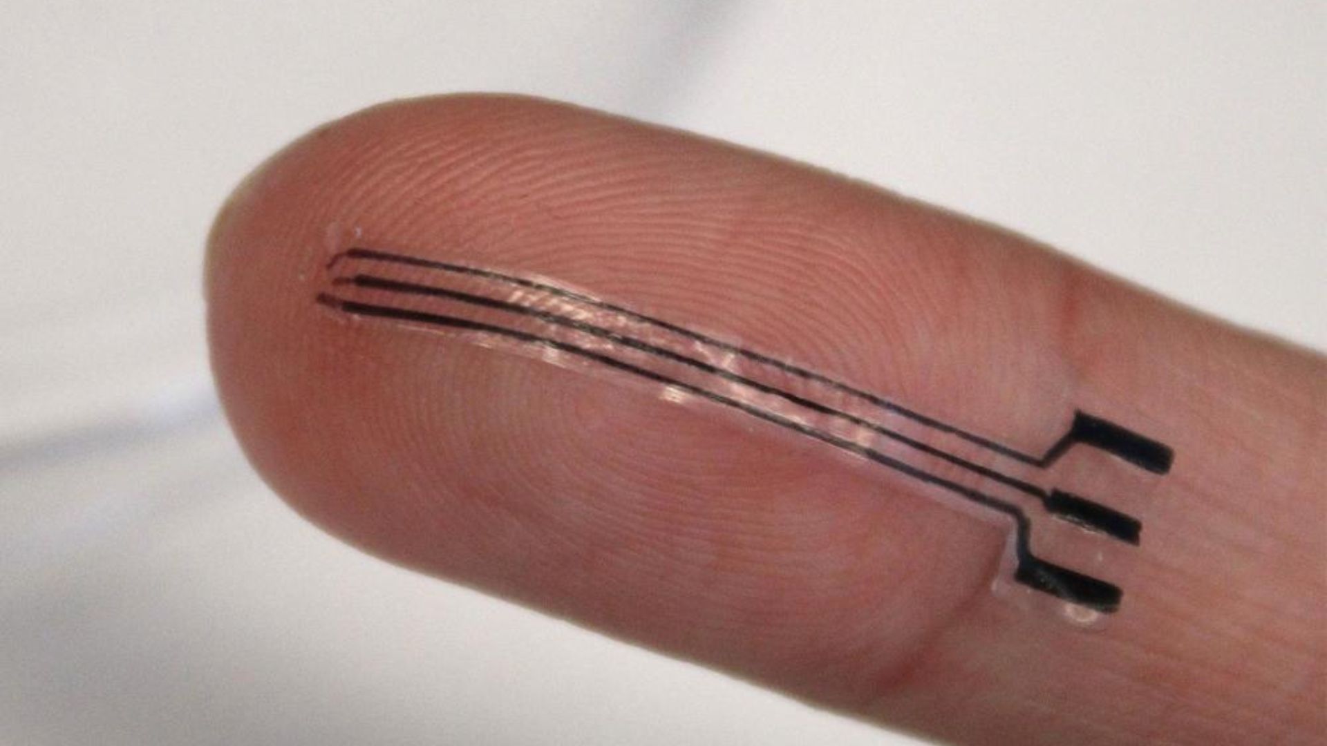 3D-printed stretchable artery implant lowers blood pressure by 15% in early trials