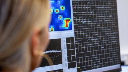 Brain-Computer-Interface: Hirn-Schnittstelle aus München soll Roboterarm steuern