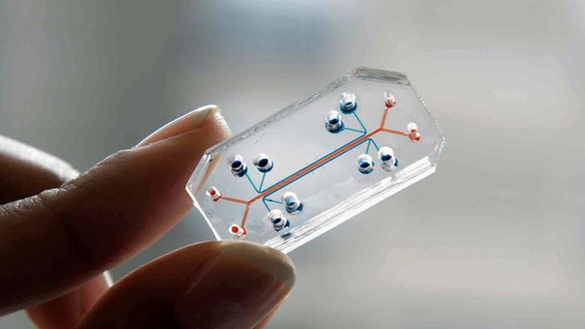 Human gut chip reveals three hidden drivers behind IBD damage and cancer risk