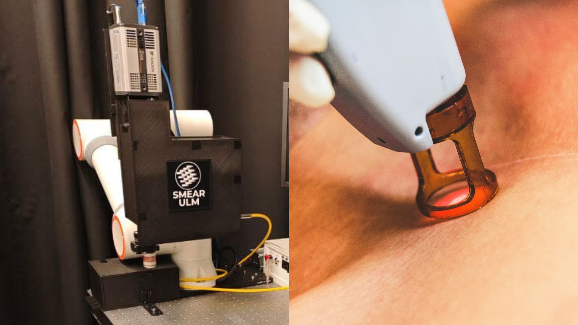New nanoparticle-based ‘intelligent tattoo’ uses heat signals to detect skin cancer