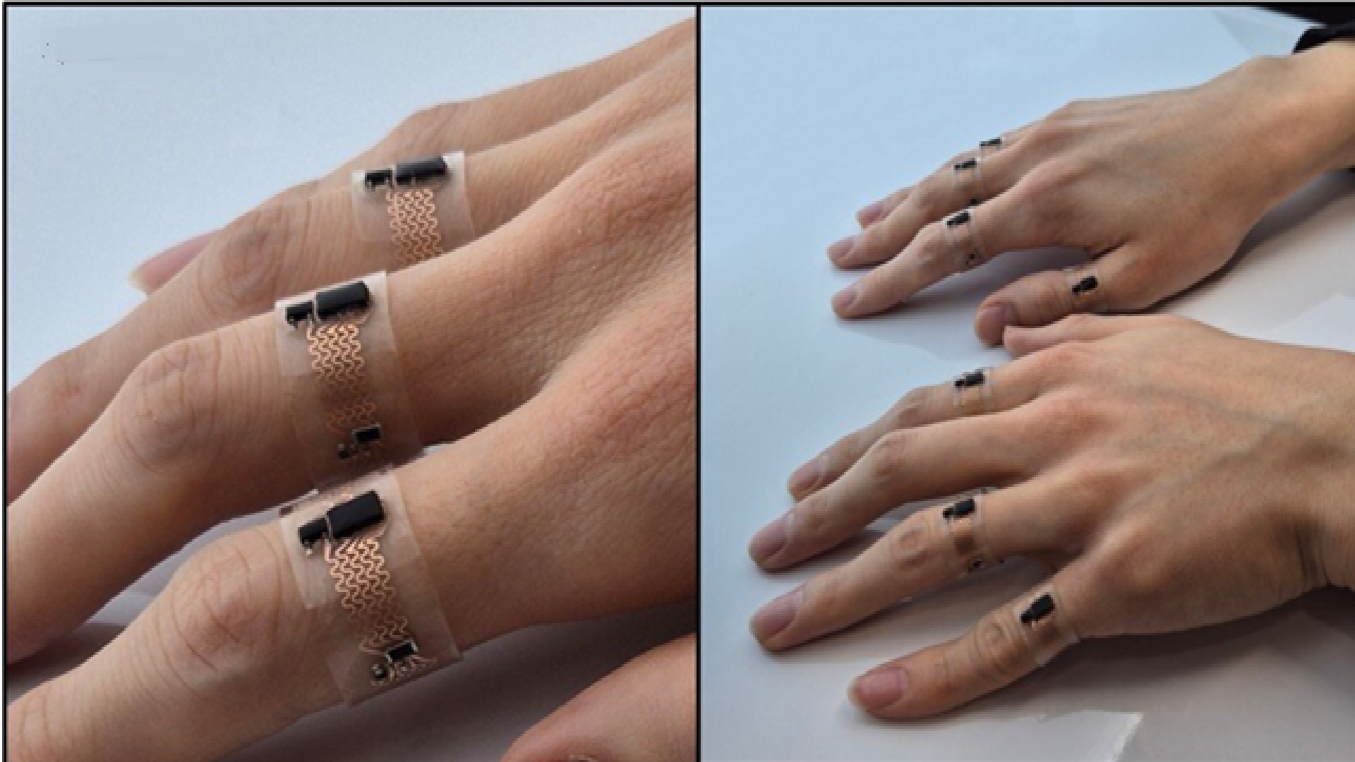 One-of-its-kind ‘smart rings’ could break sign language barrier for 300 million people