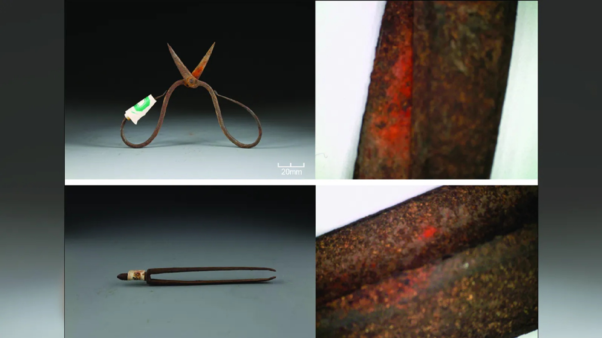 Wolfsbane residue on Ming dynasty surgeon’s tools may be oldest evidence of anesthesia