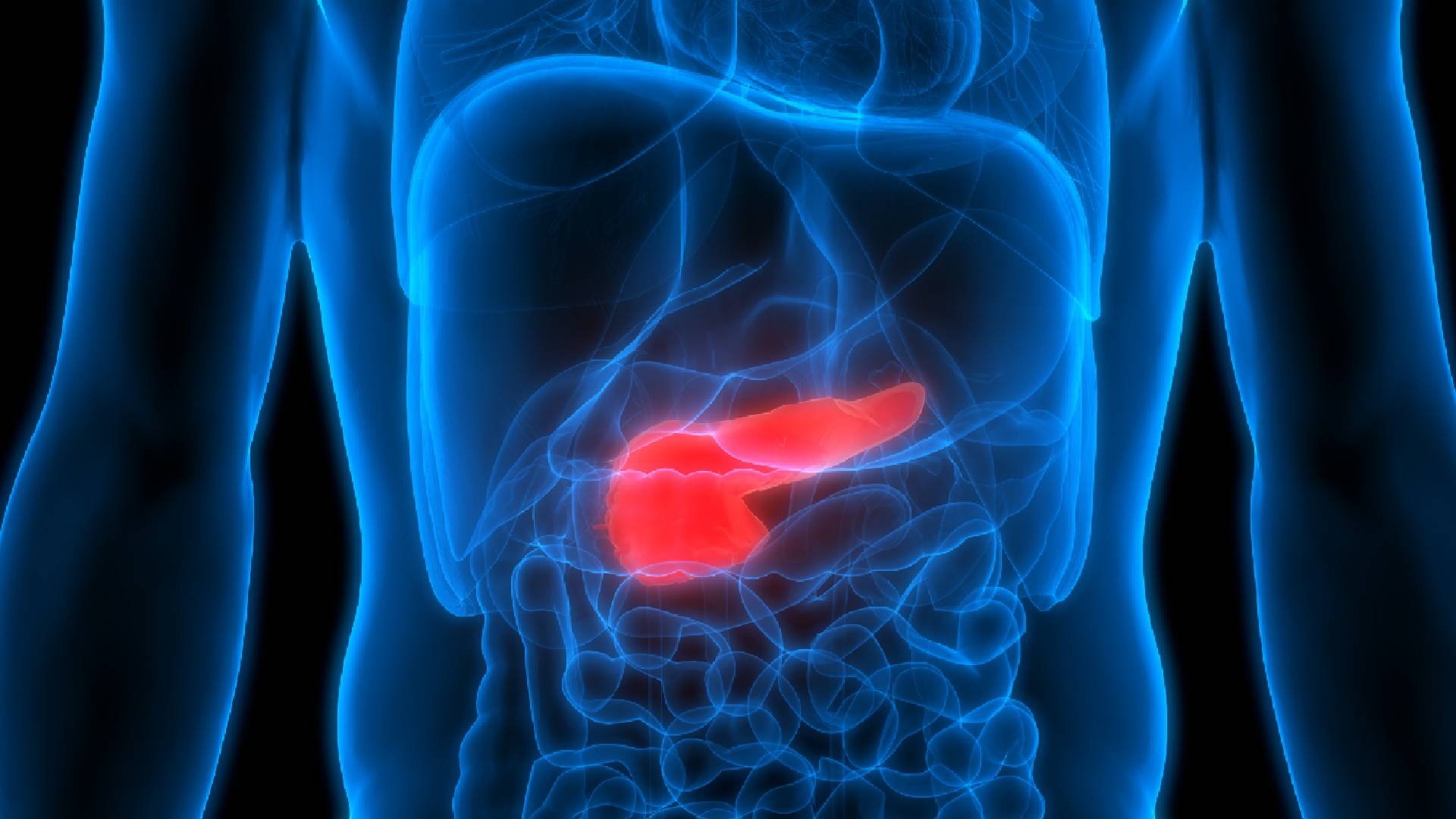 Experimental pancreatic cancer drug nearly doubles survival in Phase 3 trial