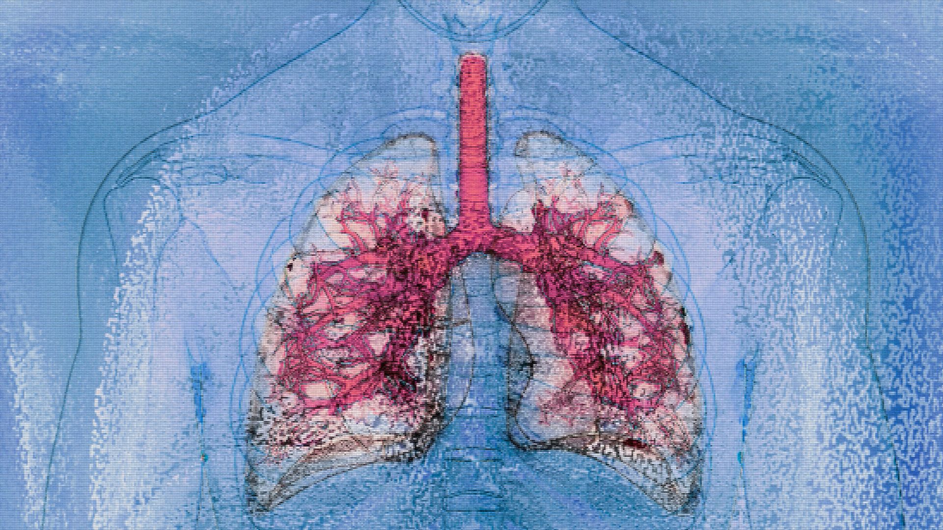 Medical miracle: World’s first HIV-to-HIV dual lung and liver transplant achieved in US