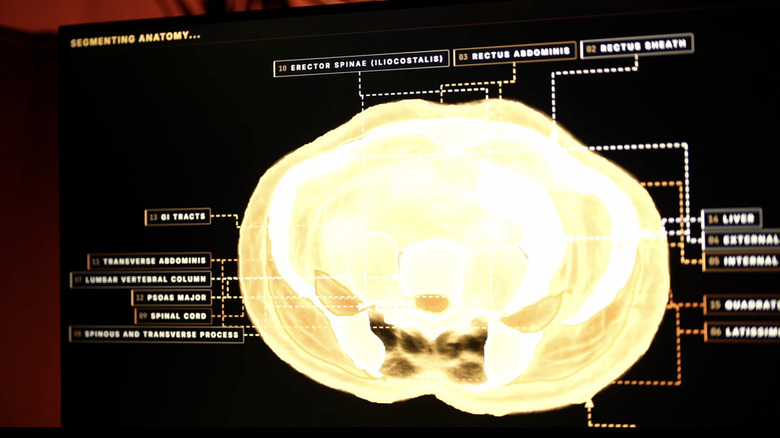 Midjourney, the AI image generator, is developing a full-body ultrasonic scanner
