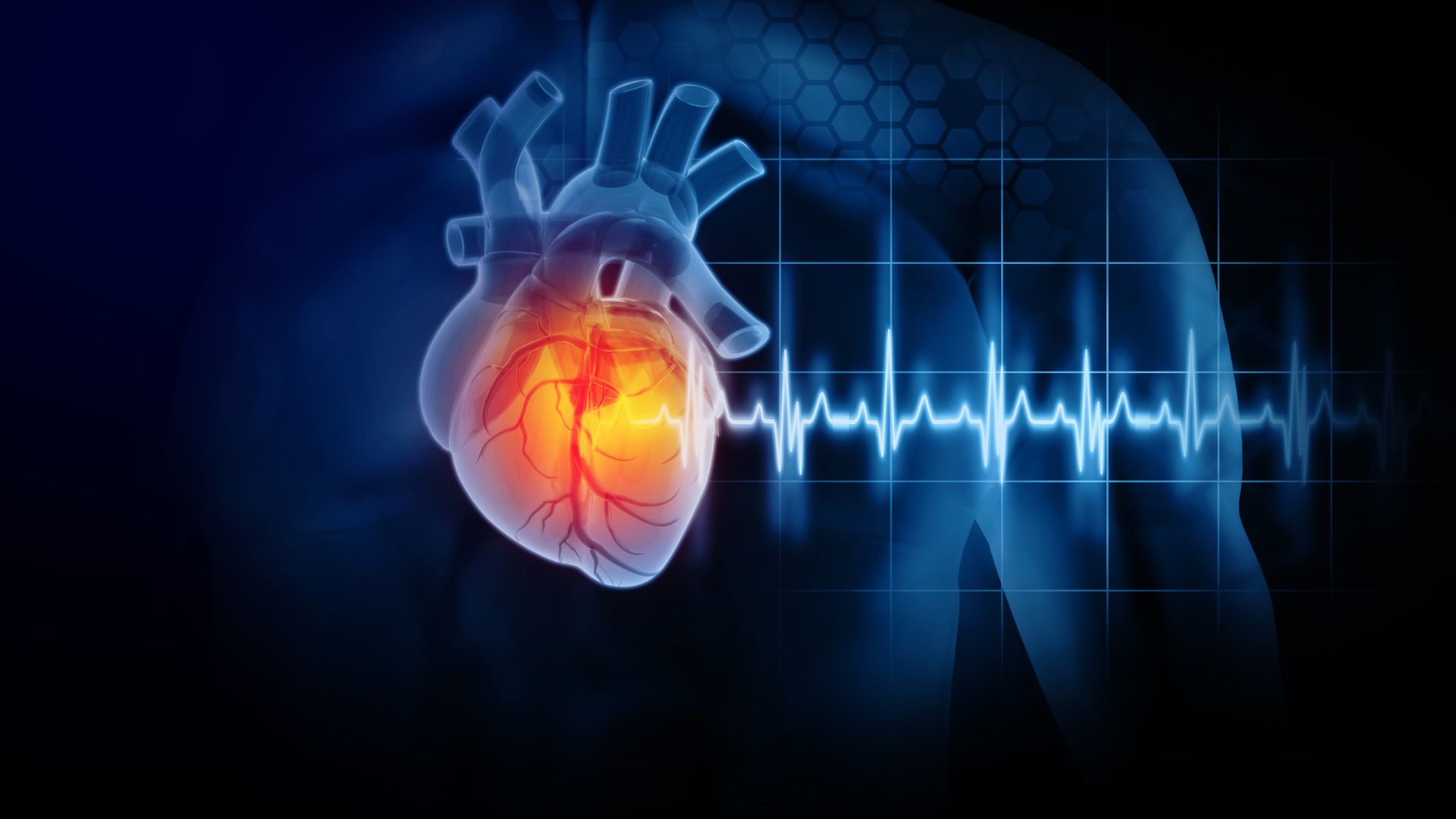 MIT’s non-invasive ultrasound pacemaker could reduce the need for cardiac implants