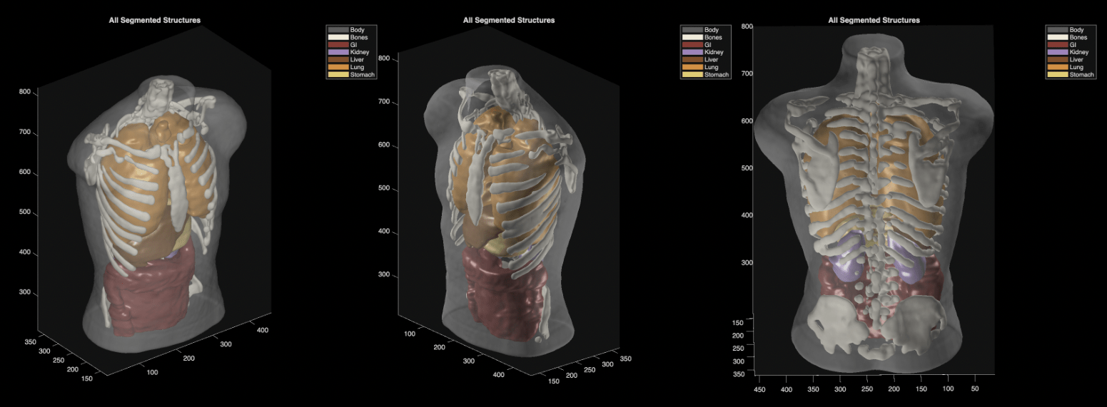 Something’s off with Midjourney’s pivot to body scanners