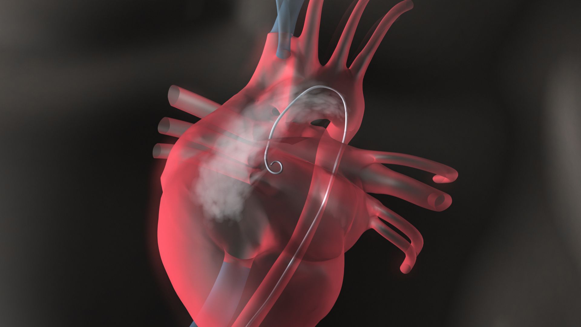 ‘World-first’ AI-backed ultrasound robot congenital heart surgery completed in China